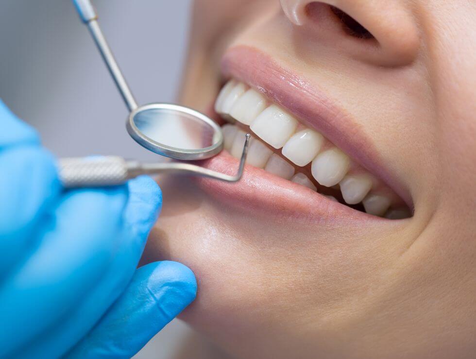 Nahaufnahme einer zahnärztlichen Kontrolle mit Spiegel und Sonde